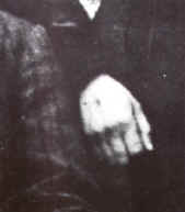 Le stimmate che Edvige portava nelle mani